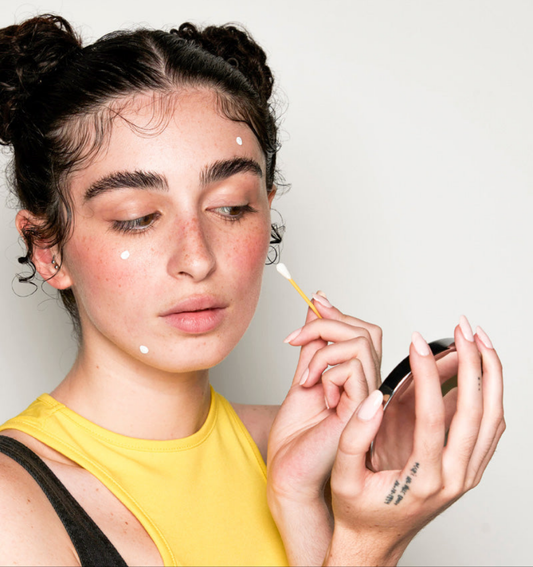 Acnemy Dryzit® Spot Drying Lotion