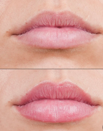 TRANSPARENT LAB Volume Hydrating Lip-Plumping Treatment